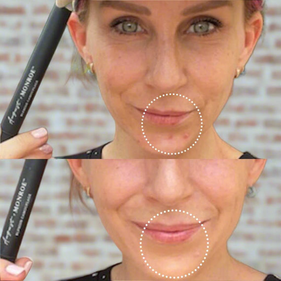 Before and after using August+Monroe Blemish Camouflage on acne