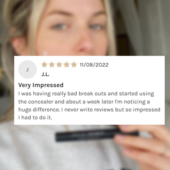 Blemish Camouflage stick – pimple concealer and acne treatment